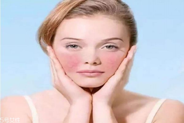 臉上出油長痘怎么調(diào)理 油臉長痘巧妙辦法 臉上出油長痘怎么調(diào)理 油臉長痘巧妙辦法