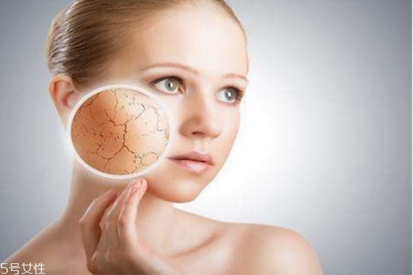 皮膚干燥吃什么好 皮膚干燥如何改善 皮膚干燥吃什么好 皮膚干燥如何改善
