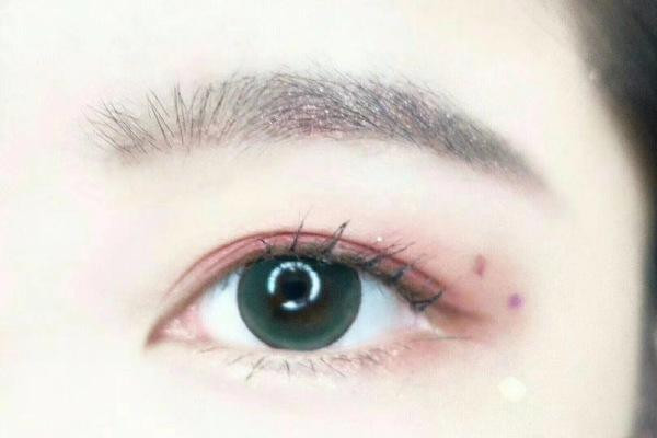 美瞳的危害 怎么避免美瞳的危害 美瞳的危害 怎么避免美瞳的危害