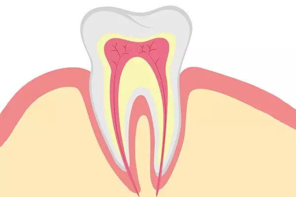 錯頜有哪些矯正方法 錯頜矯正器有哪些 錯頜有哪些矯正方法 錯頜矯正器有哪些