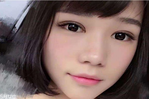 內(nèi)雙割雙眼皮容易嗎 割雙眼皮有什么注意的呢 內(nèi)雙割雙眼皮容易嗎 割雙眼皮有什么注意的呢