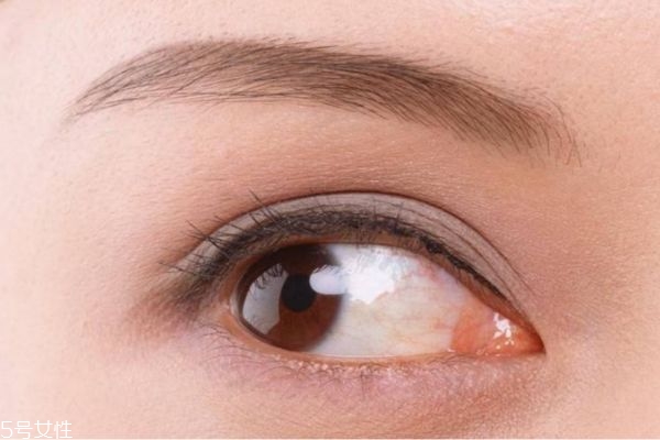 開眼角和割雙眼皮有什么區(qū)別呢 開眼角有要注意的嗎 開眼角和割雙眼皮有什么區(qū)別呢 開眼角有要注意的嗎