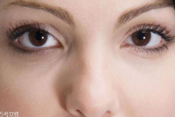 腫眼泡怎么快速消腫 腫眼泡形成的原因 腫眼泡怎么快速消腫 腫眼泡形成的原因