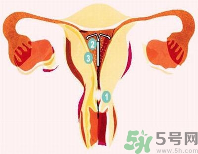 上環(huán)的最佳時(shí)間是什么時(shí)候？上環(huán)的壞處是什么？