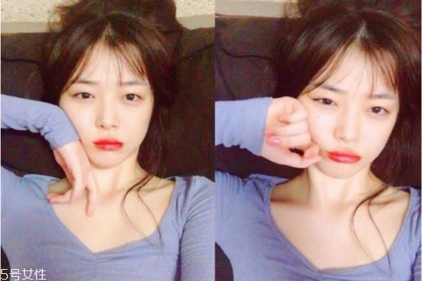 法國(guó)水光針菲洛嘉好嗎 菲洛嘉水光針的效果 法國(guó)水光針菲洛嘉好嗎 菲洛嘉水光針的效果