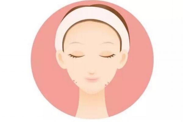 太陽穴為什么老長痘痘呢 太陽穴長痘痘原因是什么呢 太陽穴為什么老長痘痘呢 太陽穴長痘痘原因是什么呢