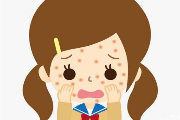 麻疹是怎么樣傳播的呢 麻疹的易感染人群是哪些呢 麻疹是怎么樣傳播的呢 麻疹的易感染人群是哪些呢