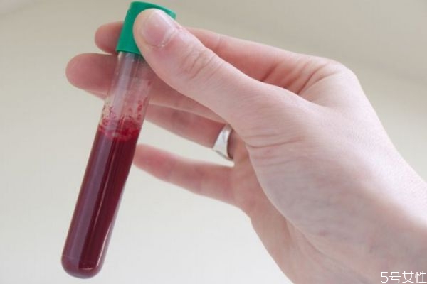 麻疹是怎么樣傳播的呢 麻疹的易感染人群是哪些呢 麻疹是怎么樣傳播的呢 麻疹的易感染人群是哪些呢