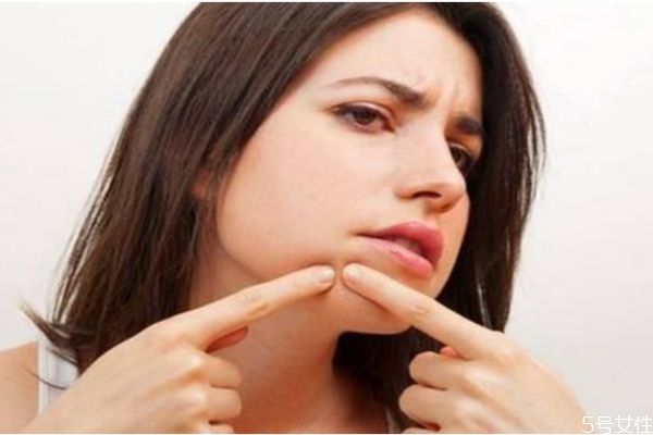 臉上長膿包是為什么呢 造成膿包的原因有什么呢 臉上長膿包是為什么呢 造成膿包的原因有什么呢