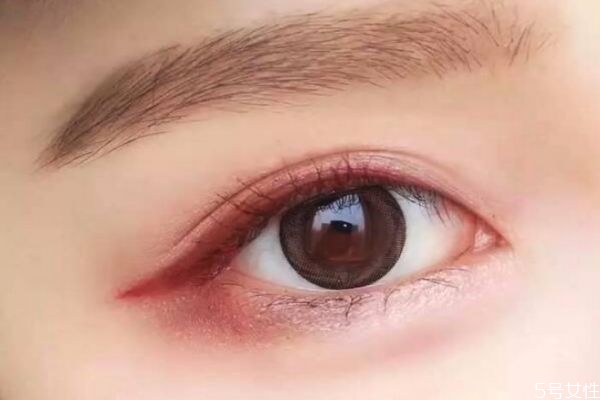 開內(nèi)眼角眼睛會(huì)變大嗎 開內(nèi)眼角恢復(fù)過程