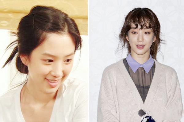 拉皮手術(shù)多久能恢復(fù) 拉皮手術(shù)會(huì)留疤嗎 拉皮手術(shù)多久能恢復(fù) 拉皮手術(shù)會(huì)留疤嗎