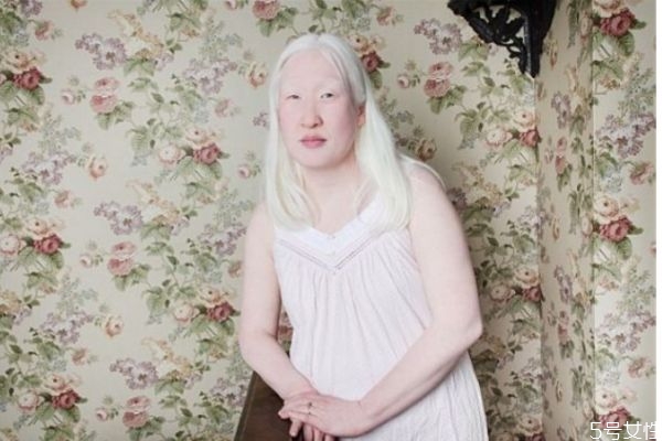 什么是白化病呢 白化病有什么危害呢 什么是白化病呢 白化病有什么危害呢