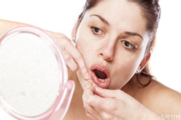 經(jīng)期如何預防長痘 經(jīng)期長痘的注意事項