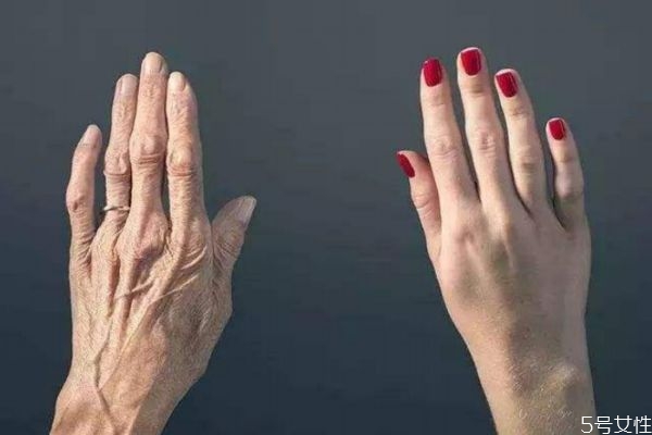 冬天用電腦辦公凍手怎么辦 冬天凍手是什么原因 冬天用電腦辦公凍手怎么辦 冬天凍手是什么原因