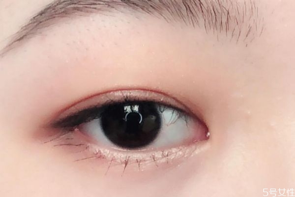 為什么會有腫眼泡呢 腫眼泡是怎么形成的呢 為什么會有腫眼泡呢 腫眼泡是怎么形成的呢