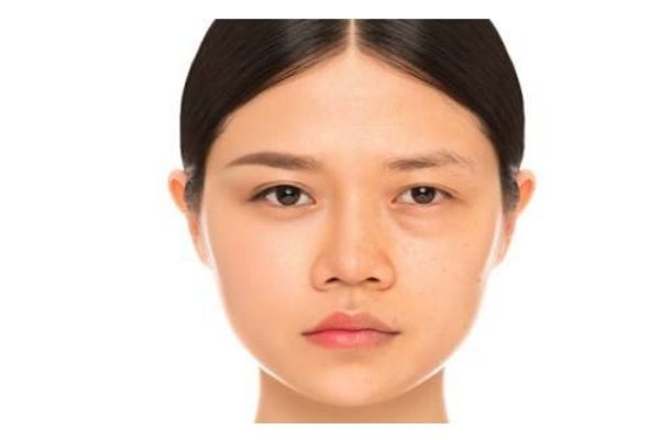 消除腫眼泡要注意什么呢 消除腫眼泡不可以做幾件事 消除腫眼泡要注意什么呢 消除腫眼泡不可以做幾件事