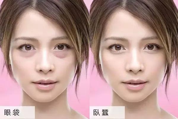 刮痧對消除眼袋有作用嗎 如何刮痧去眼袋 刮痧對消除眼袋有作用嗎 如何刮痧去眼袋