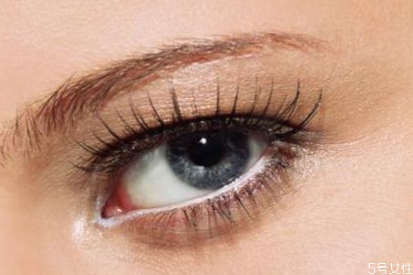 開眼角多久可以恢復呢 開眼角什么時候看沾水呢 開眼角多久可以恢復呢 開眼角什么時候看沾水呢