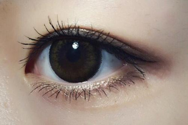 冬季做雙眼皮術(shù)好嗎 冬季做雙眼皮術(shù)恢復(fù)要多久