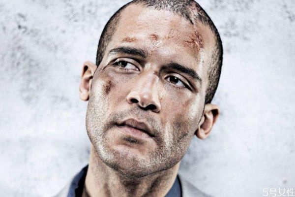 什么是科塔爾綜合癥呢 科塔爾綜合癥有什么癥狀呢 什么是科塔爾綜合癥呢 科塔爾綜合癥有什么癥狀呢