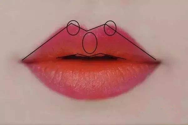 自體脂肪豐唇術效果怎么樣 自體脂肪豐唇術術后護理 自體脂肪豐唇術效果怎么樣 自體脂肪豐唇術術后護理