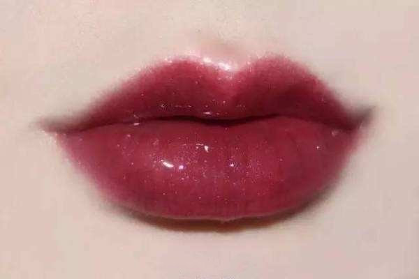 自體脂肪豐唇術效果怎么樣 自體脂肪豐唇術術后護理 自體脂肪豐唇術效果怎么樣 自體脂肪豐唇術術后護理