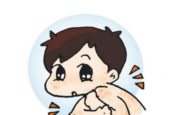 濕疹的形成原因有什么呢 如何治療濕疹呢 濕疹的形成原因有什么呢 如何治療濕疹呢