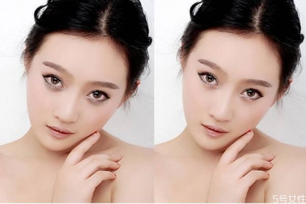 什么是復(fù)合彩光去除黑眼圈呢 復(fù)合彩光去除黑眼圈好嗎 什么是復(fù)合彩光去除黑眼圈呢 復(fù)合彩光去除黑眼圈好嗎