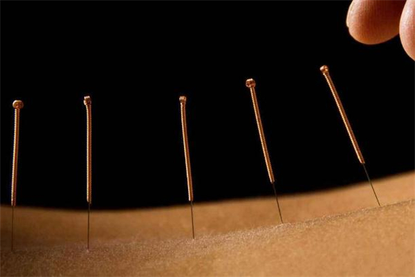 針灸減肥價格是多少 針灸減肥會反彈嗎 針灸減肥價格是多少 針灸減肥會反彈嗎