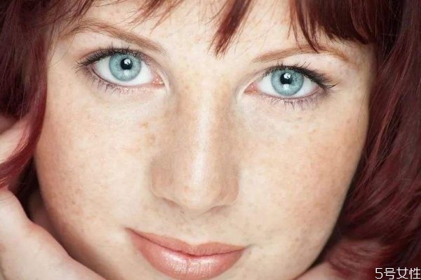 什么是色斑呢 為什么臉上會(huì)出現(xiàn)色斑呢 什么是色斑呢 為什么臉上會(huì)出現(xiàn)色斑呢