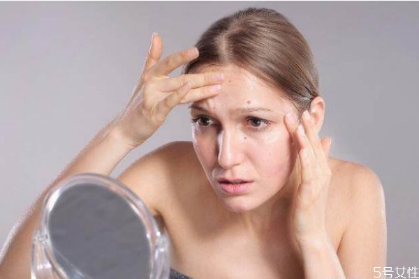 為什么經(jīng)常長痘痘 常年長痘痘怎么辦 為什么經(jīng)常長痘痘 常年長痘痘怎么辦