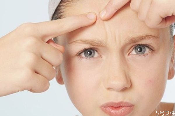 刷酸后多久能洗臉 刷酸正確的護(hù)膚步驟 刷酸后多久能洗臉 刷酸正確的護(hù)膚步驟