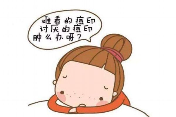 痘印發(fā)紅是為什么呢 造成痘印發(fā)紅的原因是什么呢 痘印發(fā)紅是為什么呢 造成痘印發(fā)紅的原因是什么呢