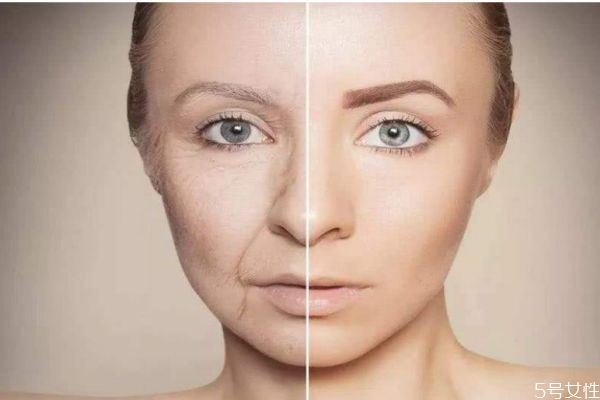 果酸換膚有什么危害嗎 果酸換膚有什么副作用呢 果酸換膚有什么危害嗎 果酸換膚有什么副作用呢