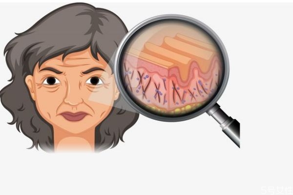 皮膚衰老主要的特征有什么呢 如何預(yù)防皮膚衰老呢 皮膚衰老主要的特征有什么呢 如何預(yù)防皮膚衰老呢