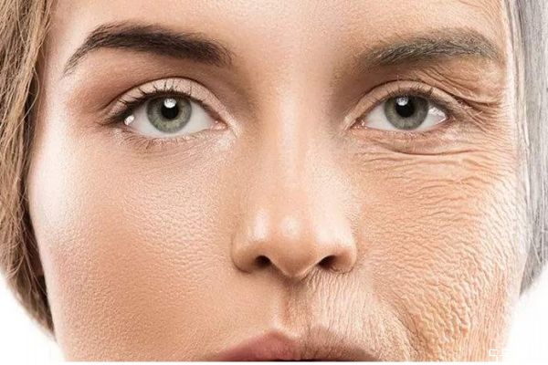 皮膚衰老主要的特征有什么呢 如何預(yù)防皮膚衰老呢 皮膚衰老主要的特征有什么呢 如何預(yù)防皮膚衰老呢