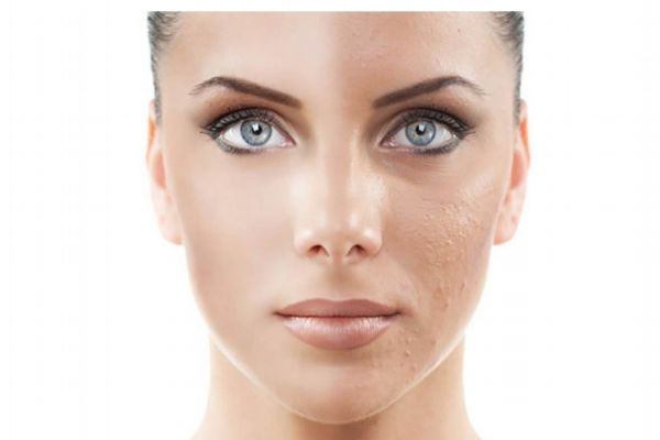 皮膚衰老從什時(shí)候開(kāi)始呢 皮膚衰老主要原因是什么呢