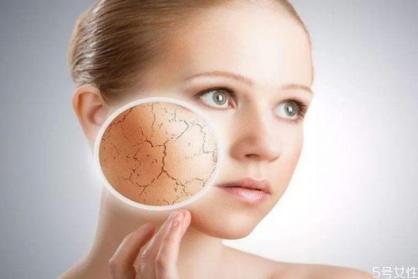 紫外線會(huì)讓皮膚衰老嗎 紫外線讓皮膚衰老原因有什么呢 紫外線會(huì)讓皮膚衰老嗎 紫外線讓皮膚衰老原因有什么呢