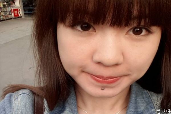 臉部的長(zhǎng)的痣可以去掉嗎 臉部的痣有什么講究嗎