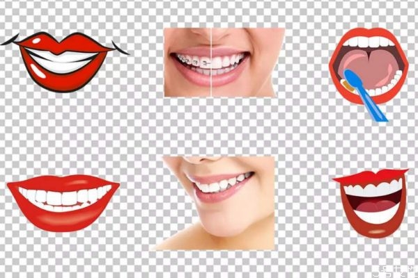 冷光美白牙齒疼嗎 如何減輕冷光美白牙齒的疼痛呢 冷光美白牙齒疼嗎 如何減輕冷光美白牙齒的疼痛呢