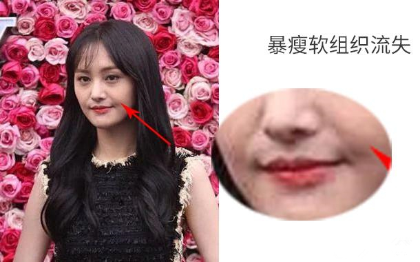 什么樣的人容易有法令紋 什么樣的人容易有法令紋