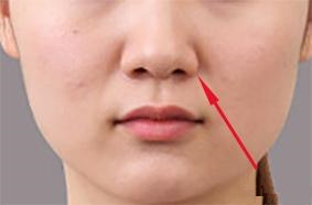 什么樣的人容易有法令紋 什么樣的人容易有法令紋