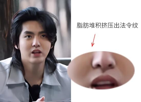 什么樣的人容易有法令紋 什么樣的人容易有法令紋