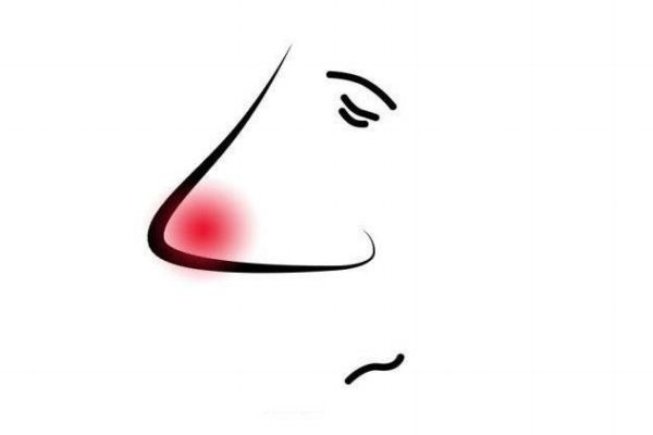 鼻子發(fā)紅是為什么呢 鼻子紅是因?yàn)楦忻皢? alt=