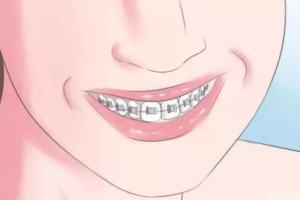 敏感牙齒怎么做脫敏治療呢 牙齒脫敏治療需要多少錢呢 敏感牙齒怎么做脫敏治療呢 牙齒脫敏治療需要多少錢呢