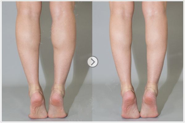 怎么用保鮮膜減肥 保鮮膜減肥有效果嗎 怎么用保鮮膜減肥 保鮮膜減肥有效果嗎