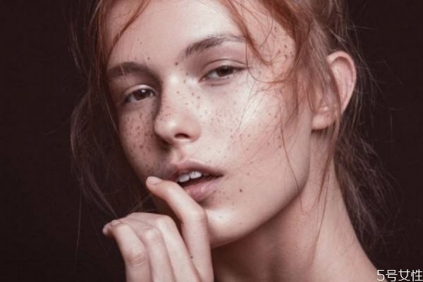 產(chǎn)婦臉上為什么會(huì)長斑 產(chǎn)后臉上的斑要多久才消失