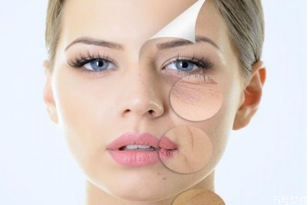 有笑紋好嗎 怎么消除笑紋呢 有笑紋好嗎 怎么消除笑紋呢