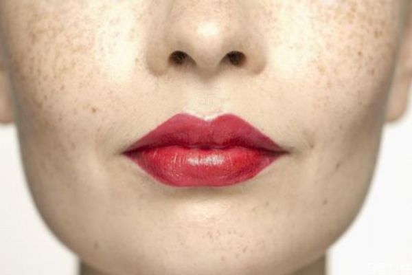 產(chǎn)婦臉上為什么會(huì)長斑 產(chǎn)后臉上的斑要多久才消失