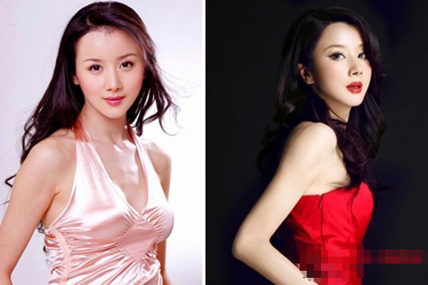 自體脂肪豐胸價(jià)格如何呢 自體脂肪豐胸一次性注入多少呢 自體脂肪豐胸價(jià)格如何呢 自體脂肪豐胸一次性注入多少呢